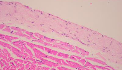 ¿Cuál es la función del endocardio?