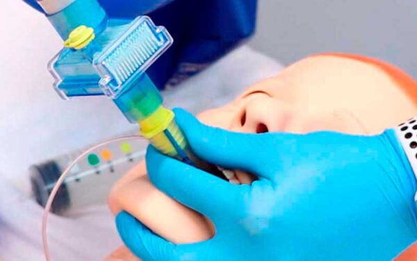 ¿Cuándo usar dispositivos para manejo avanzado de la vía aérea?