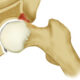 Labrum articular, disco y menisco