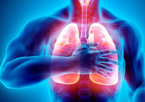 Obstrucción de las vías respiratorias