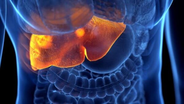 principales manifestaciones de la cirrosis hepática descompensada