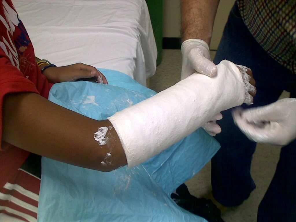 ¿Cuál es la complicación más grave cuando se colocan escayolas?