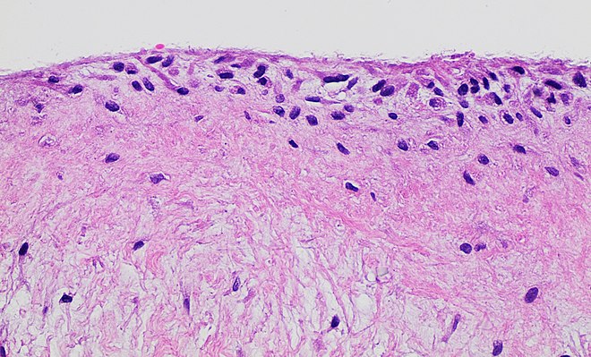 ¿Qué es la membrana sinovial?