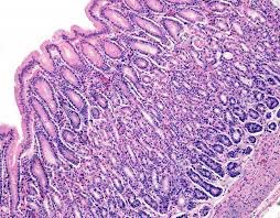 Defensa de la mucosa gástrica