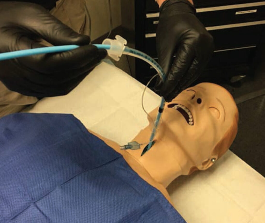 Tecnica de vía aérea quirúrgica asistida por bougie