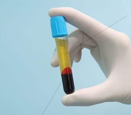 Detección sistemática de los niveles de lípidos en sangre