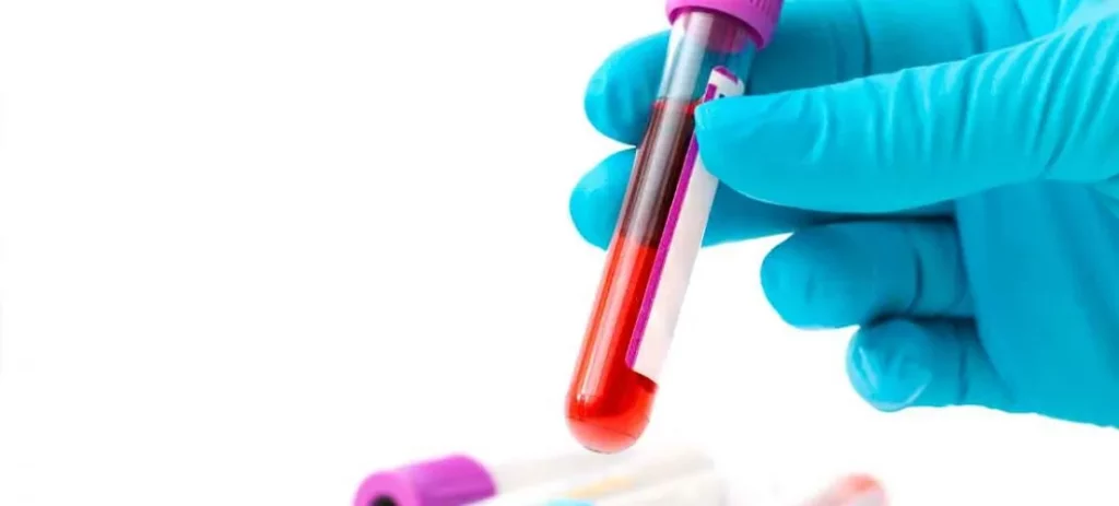 Detención de glucosa para conocer el riesgo cardiovascular