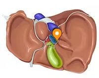 Anatomía de la cara viceral del hígado