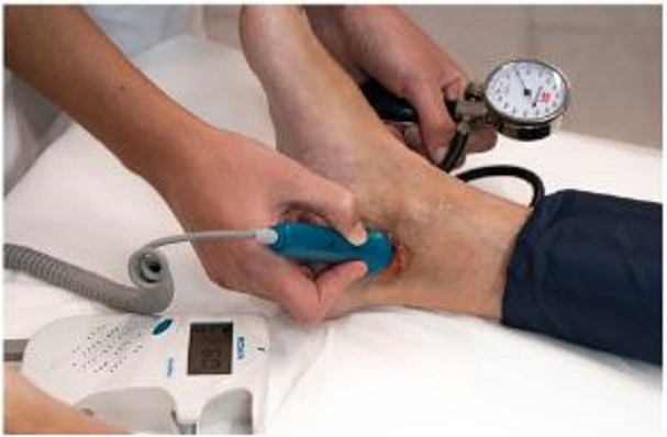 Índice tobillo brazo