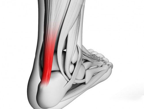 ¿Qué son los tendones?