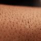 Variaciones de la piel en el cuerpo