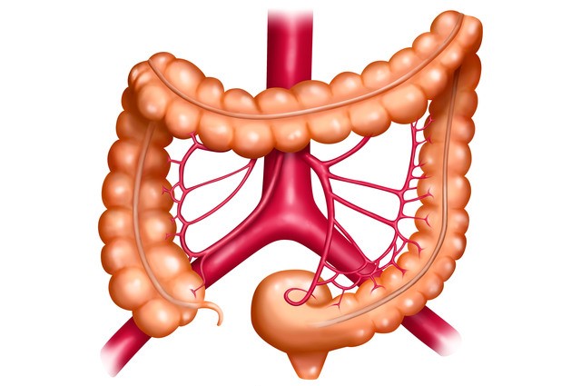 ¿Cómo se manifiesta la isquemia mesentérica?