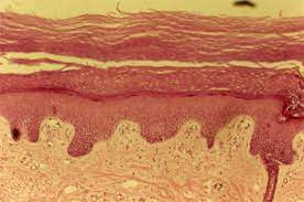 ¿Qué es la epidermis?
