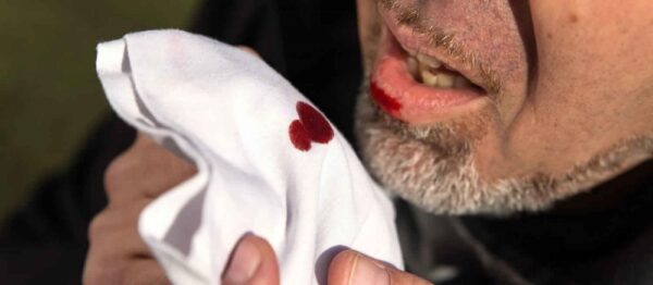 ¿Qué es la hemoptisis masiva?