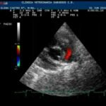 ¿Cuál es el estudio diagnóstico más preciso para la estenosis de la válvula pulmonar?