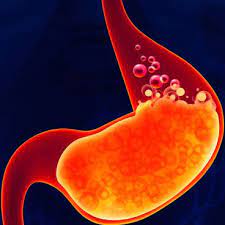 Barreras para el reflujo gastroesofágico