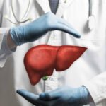 Transplante hepático en pacientes con hepatitis alcohólica