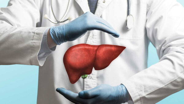 Transplante hepático en pacientes con hepatitis alcohólica