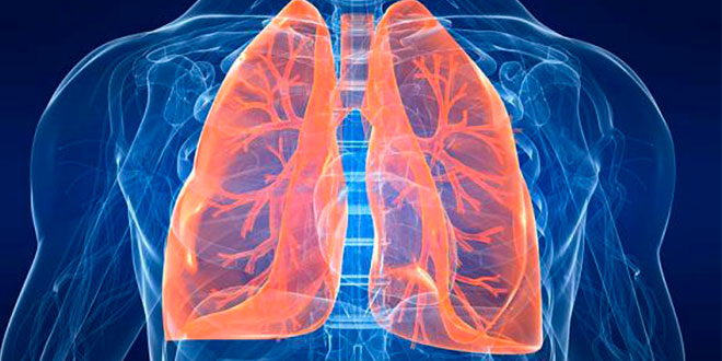 ventilación a pulmón abierto