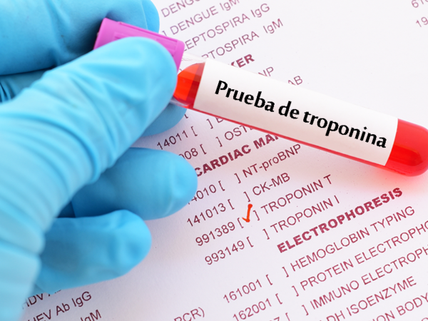 Valores de troponina como marcador