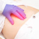 irritación peritoneal