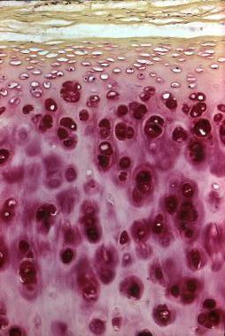 ¿Qué es la metacromasia?