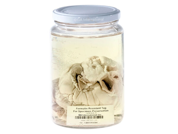 ¿Qué es la formalina?