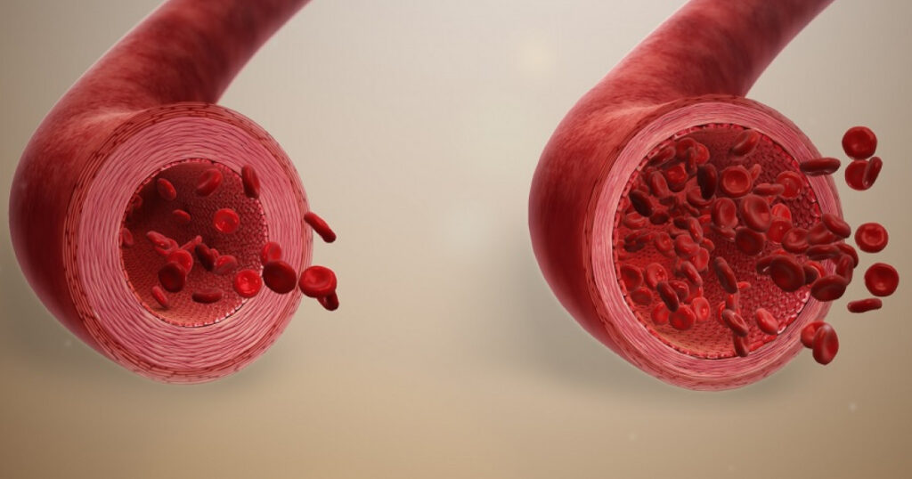 Respuesta inicial a la lesión vascular