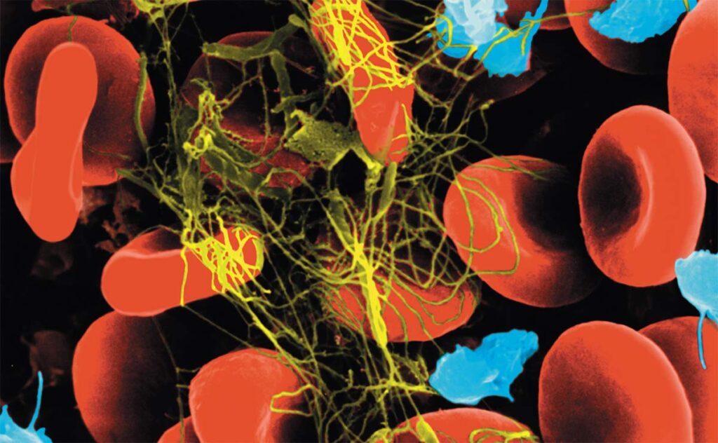 Moléculas clave en la agregación plaquetaria