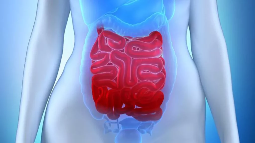 Dificultad diagnostica en hemorragias de intestino delgado