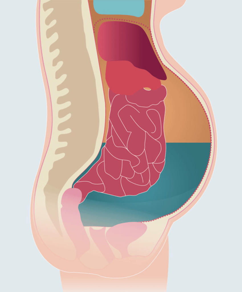 Categorias fisiopatológicas de la ascitis