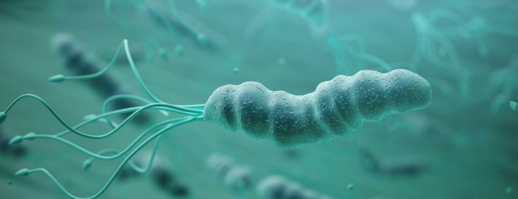 H. pylori como factor de riesgo para adenocarcinoma