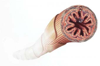 Hiperreactividad de las vías respiratorias