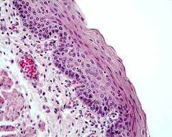 La coloración con hematoxilina y eosina