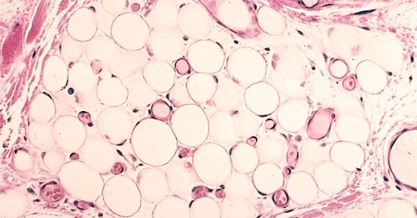 Conservación de lípidos neutros en las muestras de tejido