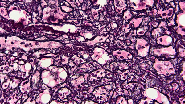 Procedimientos histoquímicos