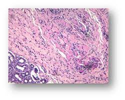 La patología como ciencia médica