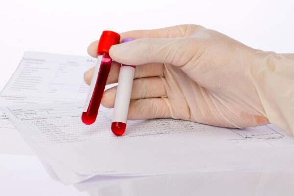 Valor del hematocrito normal en adultos