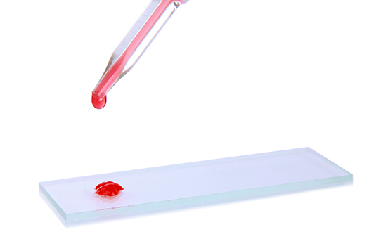 Frotis o extendido sanguíneo