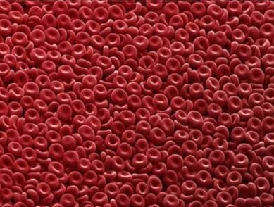 Tipos de policitemia