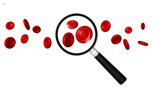 Indices eritrocitarios