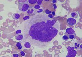 Regulación de la megacariocitopoyesis