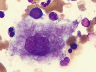 División celular de los megacariocitos