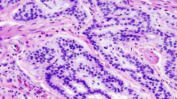 ¿Cuál es el corte de rutina en histología?