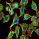 ¿Cuáles son los colorantes fluorescentes?