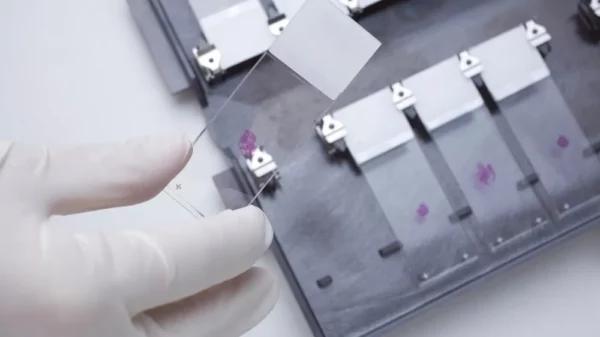 Fijadores especiales de muestras histológicas