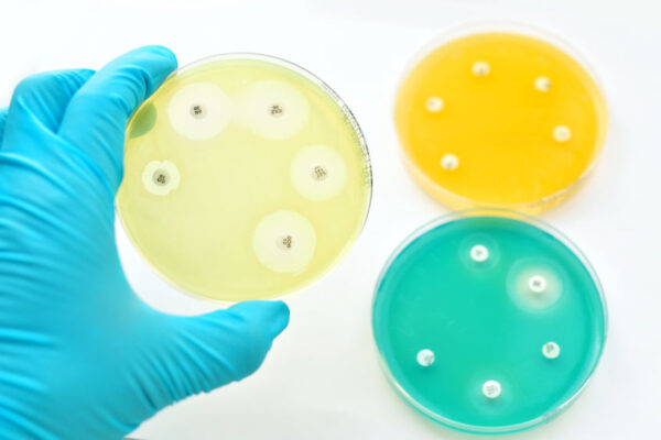 Cuantificación de la susceptibilidad bacteriana a un antibiótico