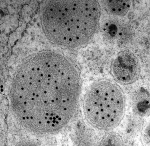 ¿Qué son las inclusiones citoplasmáticas?