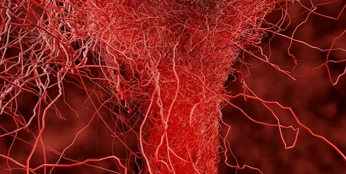La hiperglucemia crónica causa microangiopatía