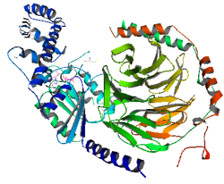 ¿Qué es la amiloidosis AL?